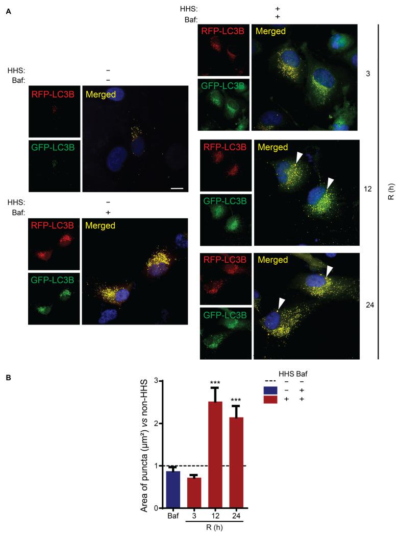 https://cdn.ncbi.nlm.nih.gov/pmc/blobs/5517/9179435/1be4995c7a81/cells-11-01778-g006.jpg