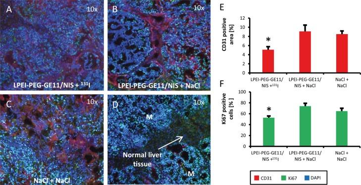 https://cdn.ncbi.nlm.nih.gov/pmc/blobs/551c/5696174/a4f0616a8649/oncotarget-08-92195-g006.jpg