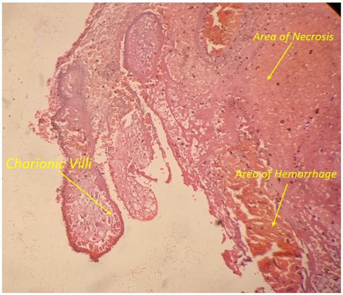 https://cdn.ncbi.nlm.nih.gov/pmc/blobs/5521/10580687/5d3383b08c07/CCR3-11-e8063-g005.jpg