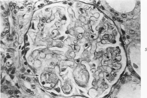 https://cdn.ncbi.nlm.nih.gov/pmc/blobs/5522/1910827/78c2c3842058/amjpathol00475-0059-a.jpg
