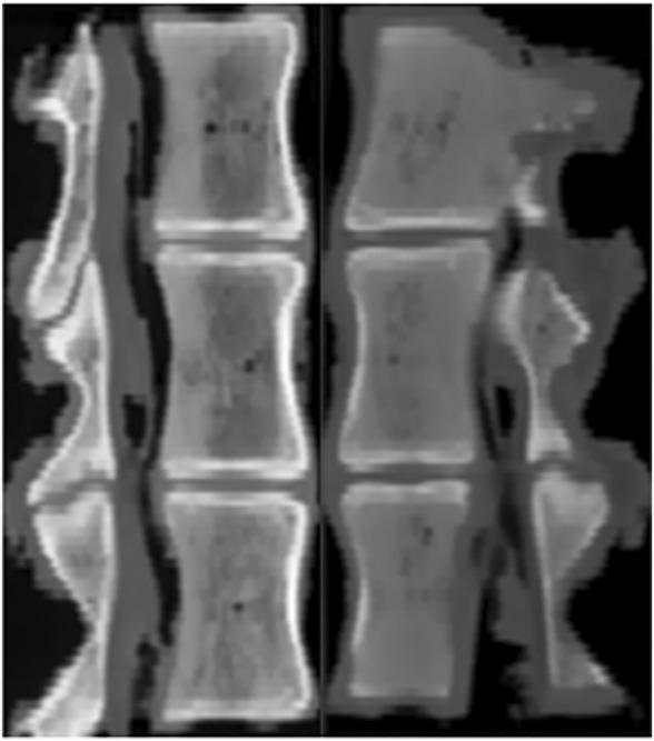 https://cdn.ncbi.nlm.nih.gov/pmc/blobs/5525/10354293/a0475109e447/fbioe-11-1218478-g002.jpg