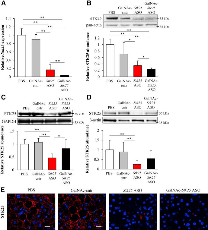 https://cdn.ncbi.nlm.nih.gov/pmc/blobs/5525/6411916/6ef0f83e4f5f/gr4.jpg