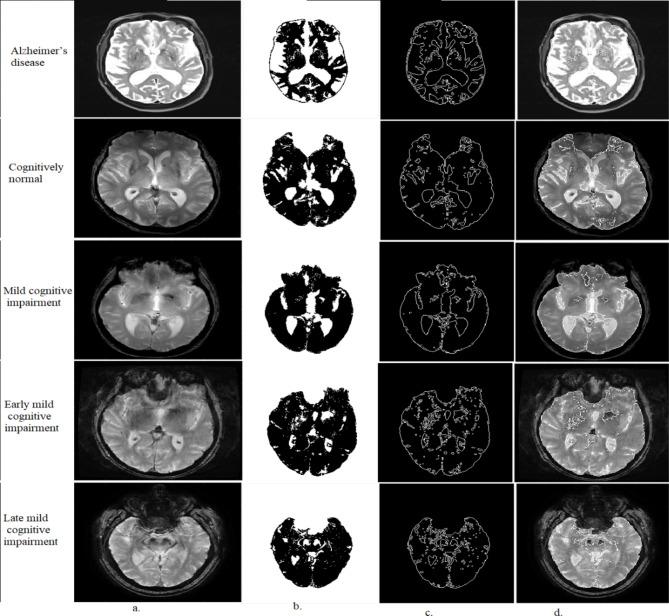 https://cdn.ncbi.nlm.nih.gov/pmc/blobs/5527/11682306/ff7682d341de/41598_2024_82544_Fig3_HTML.jpg