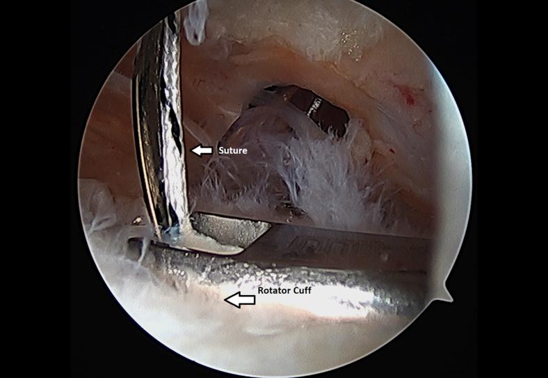 https://cdn.ncbi.nlm.nih.gov/pmc/blobs/5529/7587230/4a6f0846948e/gr10.jpg
