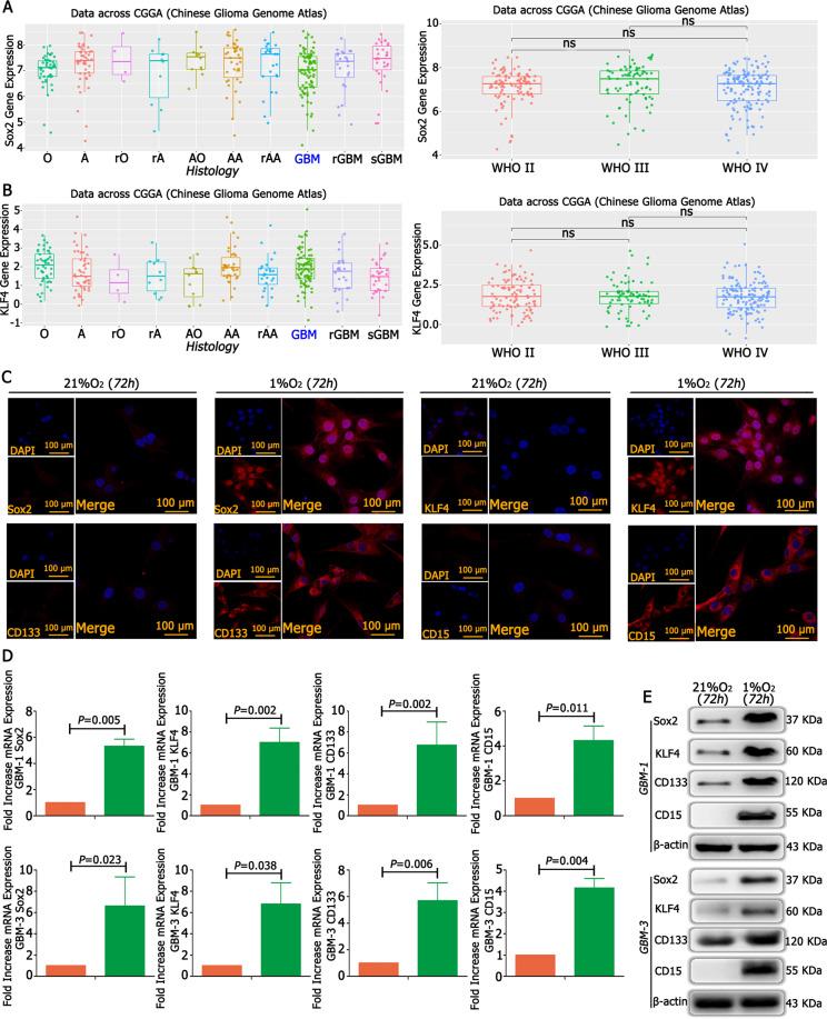 https://cdn.ncbi.nlm.nih.gov/pmc/blobs/552d/7990922/2a015bc47ea4/41419_2021_3598_Fig5_HTML.jpg