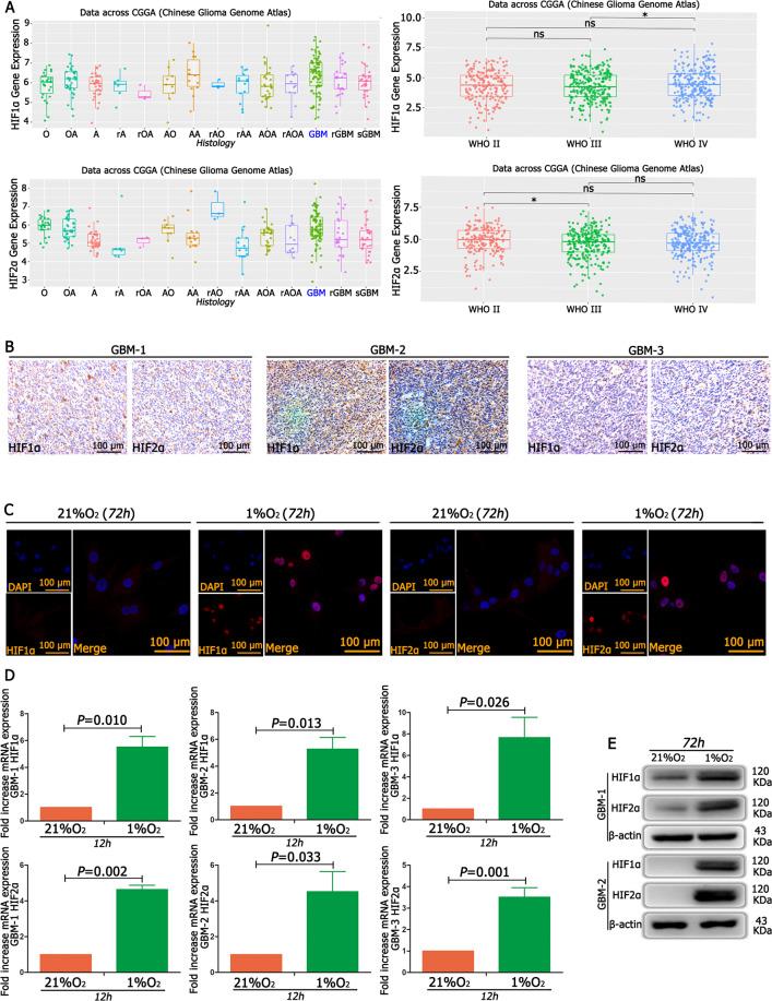 https://cdn.ncbi.nlm.nih.gov/pmc/blobs/552d/7990922/4218ddf9fd87/41419_2021_3598_Fig1_HTML.jpg