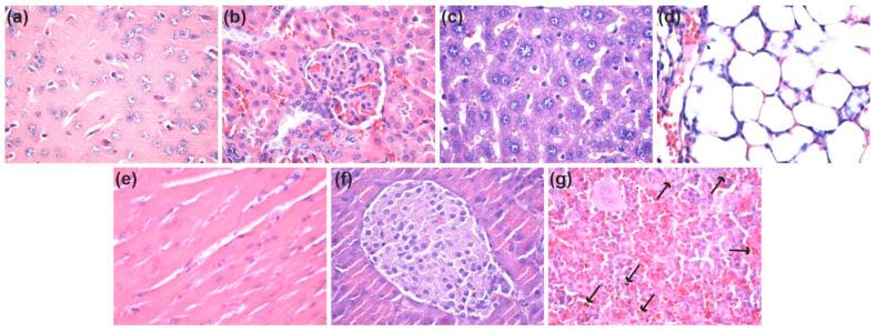 https://cdn.ncbi.nlm.nih.gov/pmc/blobs/5530/8540015/bc0c325f887f/nanomaterials-11-02564-g015.jpg