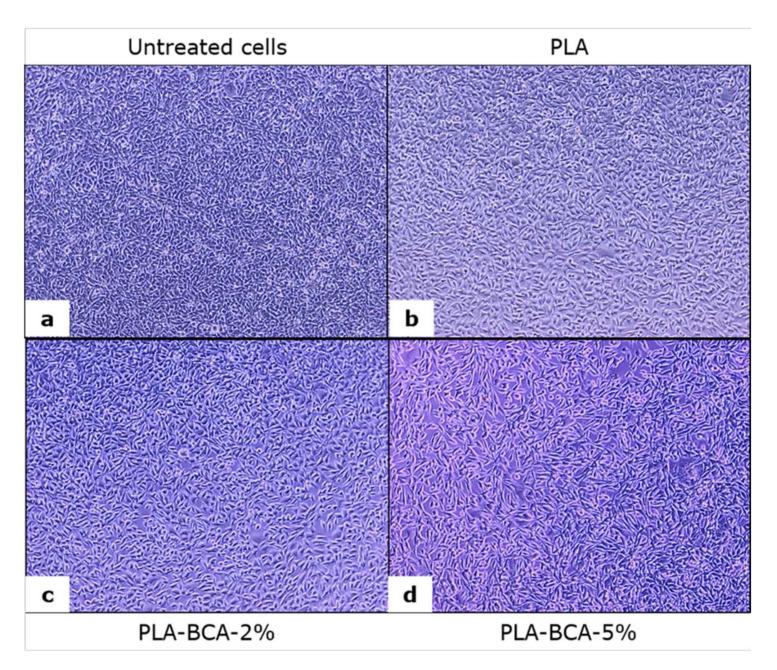 https://cdn.ncbi.nlm.nih.gov/pmc/blobs/5531/8951644/2057a3bdf39c/pharmaceutics-14-00528-g008.jpg
