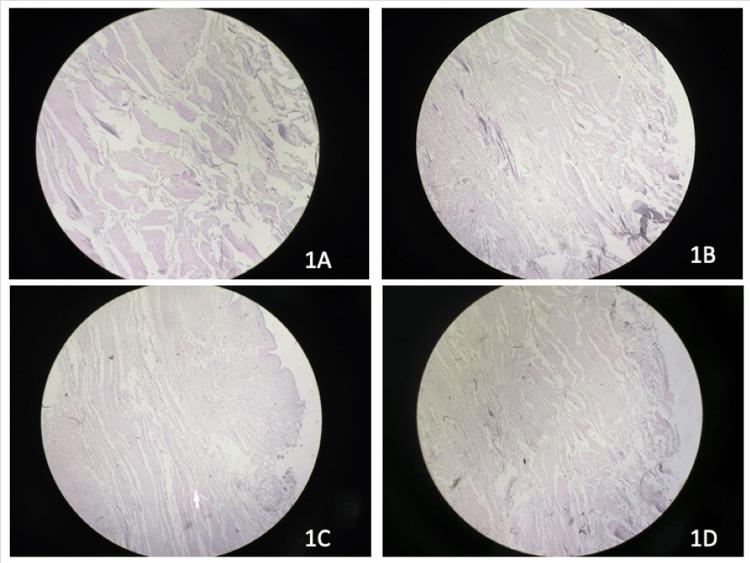 https://cdn.ncbi.nlm.nih.gov/pmc/blobs/5539/11444339/17ddefb4e497/cureus-0016-00000068394-i01.jpg