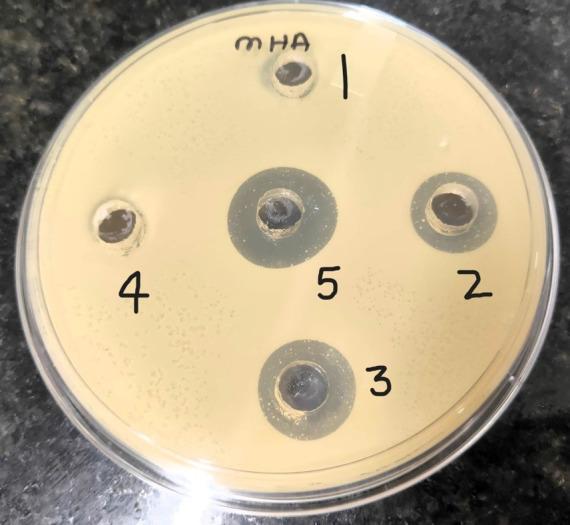 https://cdn.ncbi.nlm.nih.gov/pmc/blobs/553c/11524459/2540980ae804/pone.0312521.g004.jpg