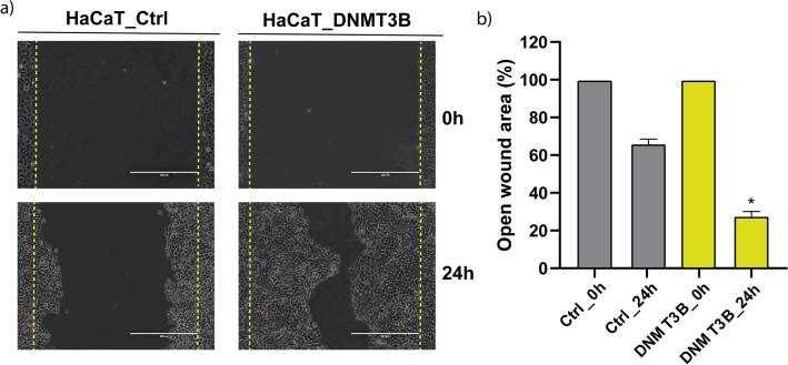https://cdn.ncbi.nlm.nih.gov/pmc/blobs/553c/9718745/43925bbdab07/41598_2022_24186_Fig6_HTML.jpg