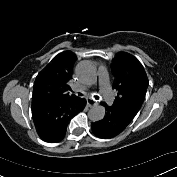 https://cdn.ncbi.nlm.nih.gov/pmc/blobs/5543/2409331/92f669e73a0a/1749-8090-3-27-2.jpg