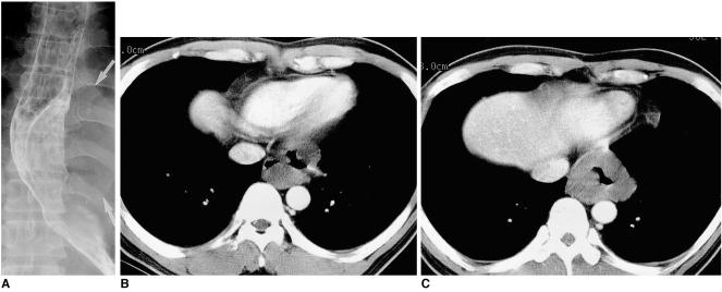 https://cdn.ncbi.nlm.nih.gov/pmc/blobs/5543/2718110/25a4c5d0e1f7/kjr-2-132-g002.jpg
