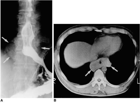 https://cdn.ncbi.nlm.nih.gov/pmc/blobs/5543/2718110/f8a25c1b7a16/kjr-2-132-g003.jpg