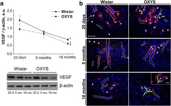 https://cdn.ncbi.nlm.nih.gov/pmc/blobs/5543/5836823/dd3f75998b4d/12864_2018_4480_Fig4_HTML.jpg