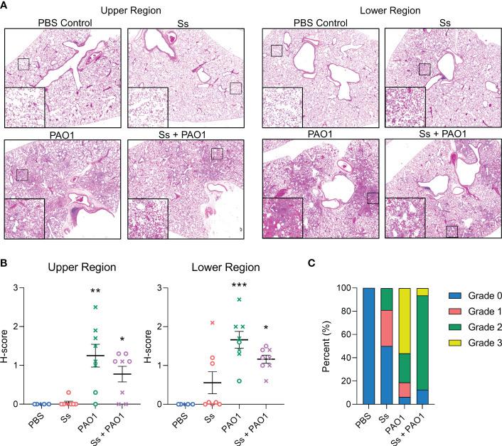 https://cdn.ncbi.nlm.nih.gov/pmc/blobs/5545/10248150/bdc52ac6e6b7/fcimb-13-1144157-g002.jpg