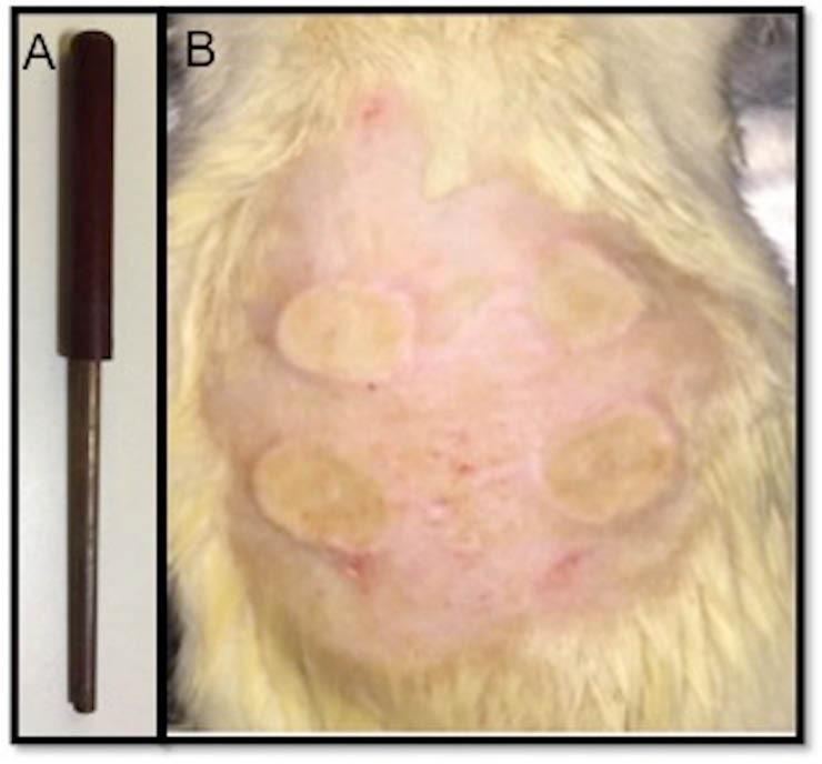 https://cdn.ncbi.nlm.nih.gov/pmc/blobs/5549/5915708/eb7324799369/bi-8-5-g001.jpg