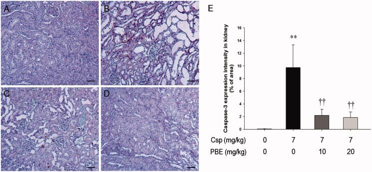 https://cdn.ncbi.nlm.nih.gov/pmc/blobs/554c/6014499/a6d21c5e0750/IRNF_A_1282871_F0002_C.jpg