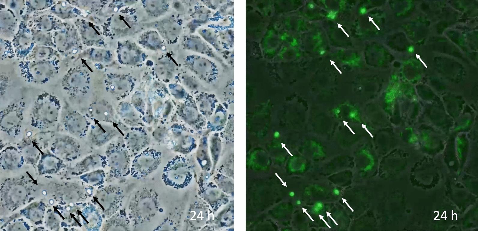 https://cdn.ncbi.nlm.nih.gov/pmc/blobs/554f/11520123/8781a0a57970/40560_2024_754_Fig5_HTML.jpg