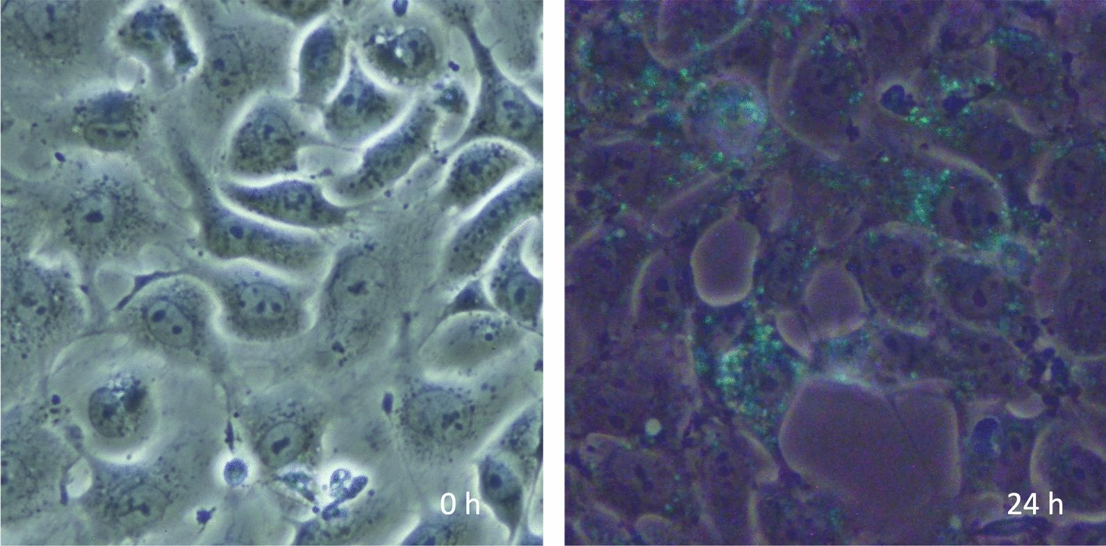 https://cdn.ncbi.nlm.nih.gov/pmc/blobs/554f/11520123/d5ddd5fb3335/40560_2024_754_Fig3_HTML.jpg