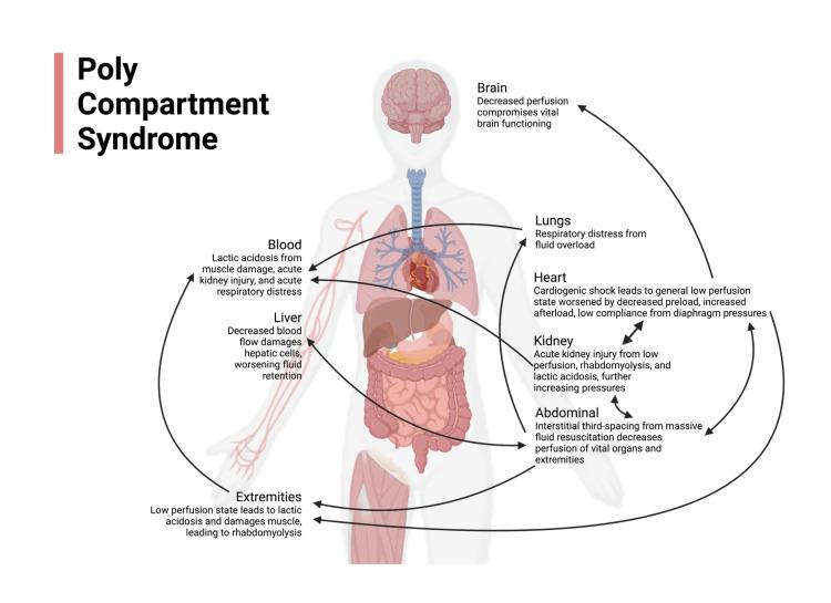 https://cdn.ncbi.nlm.nih.gov/pmc/blobs/5551/10544627/f4cd989d1fc3/cureus-0015-00000044519-i02.jpg