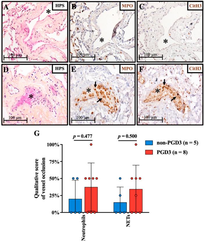 https://cdn.ncbi.nlm.nih.gov/pmc/blobs/5554/9656095/1ca39e6ef84c/cells-11-03420-g001.jpg