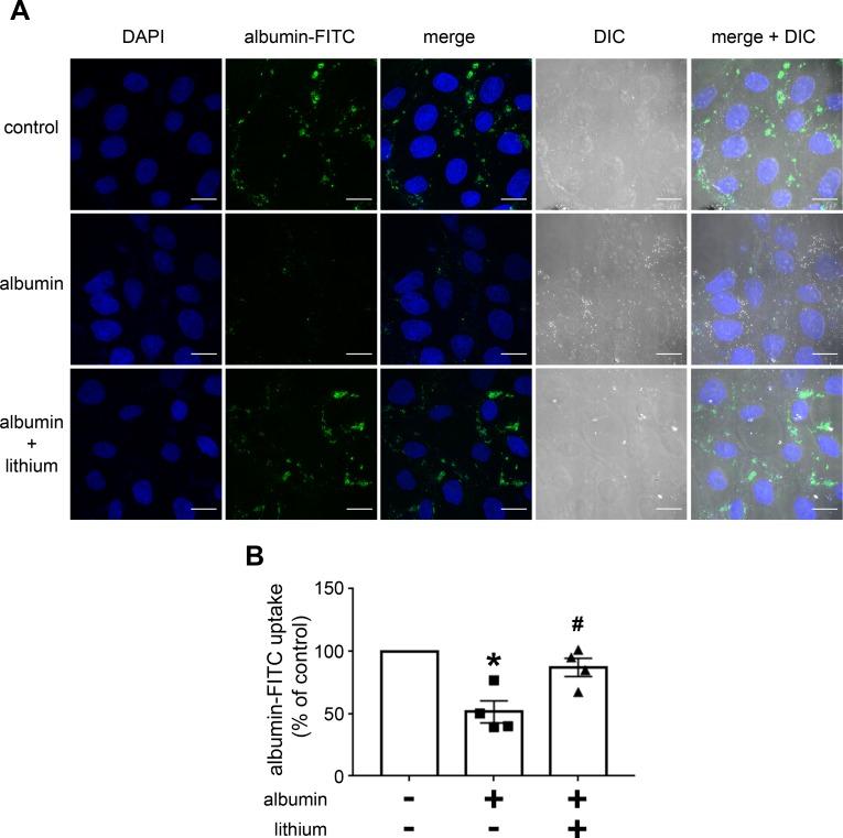 https://cdn.ncbi.nlm.nih.gov/pmc/blobs/555c/6474631/eb2bf8f53176/pone.0215871.g004.jpg