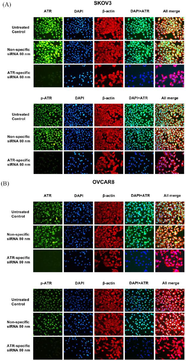 https://cdn.ncbi.nlm.nih.gov/pmc/blobs/5561/8013598/2fb083ec502d/10.1177_1758835920982853-fig5.jpg