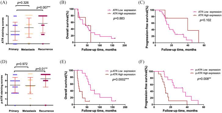 https://cdn.ncbi.nlm.nih.gov/pmc/blobs/5561/8013598/6cea0e1738df/10.1177_1758835920982853-fig3.jpg