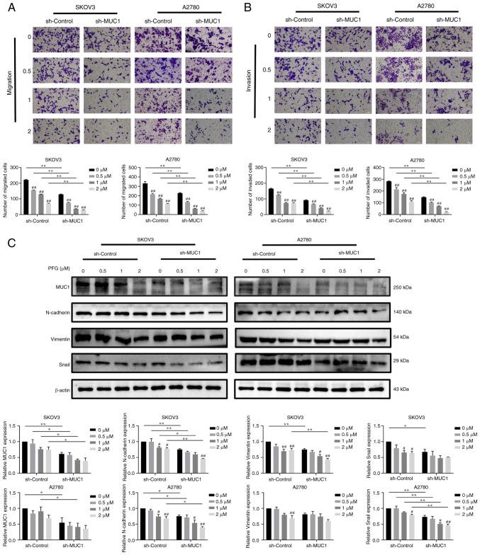 https://cdn.ncbi.nlm.nih.gov/pmc/blobs/5563/11188981/141a98c50977/ijmm-54-01-05384-g06.jpg
