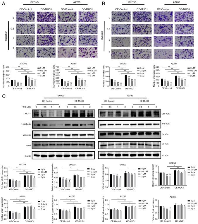 https://cdn.ncbi.nlm.nih.gov/pmc/blobs/5563/11188981/bba2e09a2470/ijmm-54-01-05384-g07.jpg