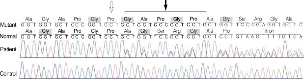 https://cdn.ncbi.nlm.nih.gov/pmc/blobs/5568/2693823/3464ece184a2/jkms-22-698-g006.jpg