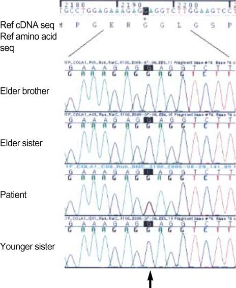 https://cdn.ncbi.nlm.nih.gov/pmc/blobs/5568/2693823/3d16a729eaf2/jkms-22-698-g004.jpg