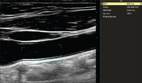 https://cdn.ncbi.nlm.nih.gov/pmc/blobs/556b/8830545/dbd2653438bf/TCMJ-34-88-g001.jpg