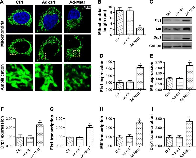 https://cdn.ncbi.nlm.nih.gov/pmc/blobs/556d/6376886/447a985ae641/ott-12-1147Fig3.jpg