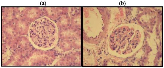 https://cdn.ncbi.nlm.nih.gov/pmc/blobs/5574/3257079/4f15e3dcfcd8/ijms-12-08431f1.jpg