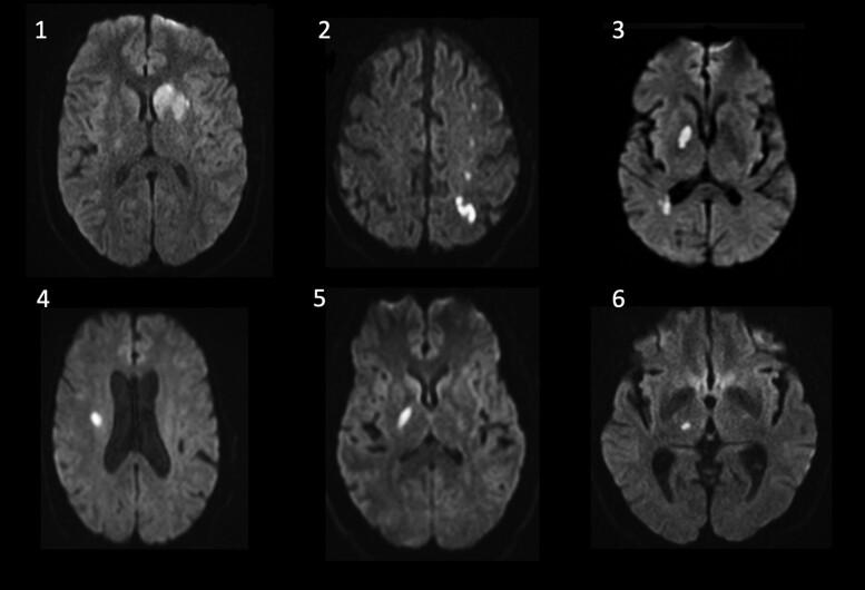 https://cdn.ncbi.nlm.nih.gov/pmc/blobs/557f/10243775/2eb07bf3bd72/fcad149f1.jpg