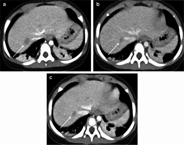 https://cdn.ncbi.nlm.nih.gov/pmc/blobs/5581/11254996/2bb8693245e2/247_2024_5953_Fig2_HTML.jpg