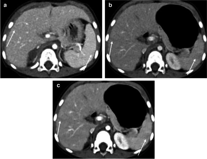 https://cdn.ncbi.nlm.nih.gov/pmc/blobs/5581/11254996/3b35002305ff/247_2024_5953_Fig3_HTML.jpg