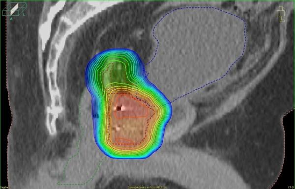 https://cdn.ncbi.nlm.nih.gov/pmc/blobs/5581/3259125/9c891bcfaa4e/1471-2407-11-503-2.jpg