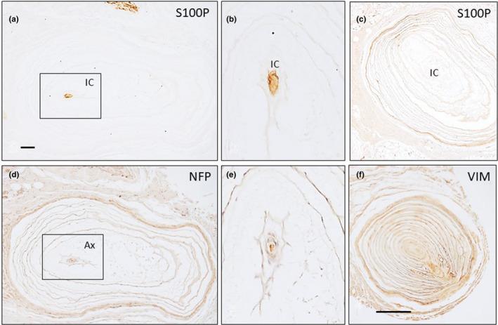 https://cdn.ncbi.nlm.nih.gov/pmc/blobs/5584/9005682/08ef77b5bdac/JOA-240-972-g007.jpg