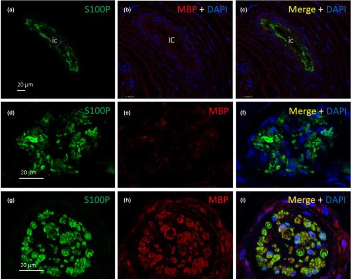 https://cdn.ncbi.nlm.nih.gov/pmc/blobs/5584/9005682/84548e1a96e0/JOA-240-972-g008.jpg