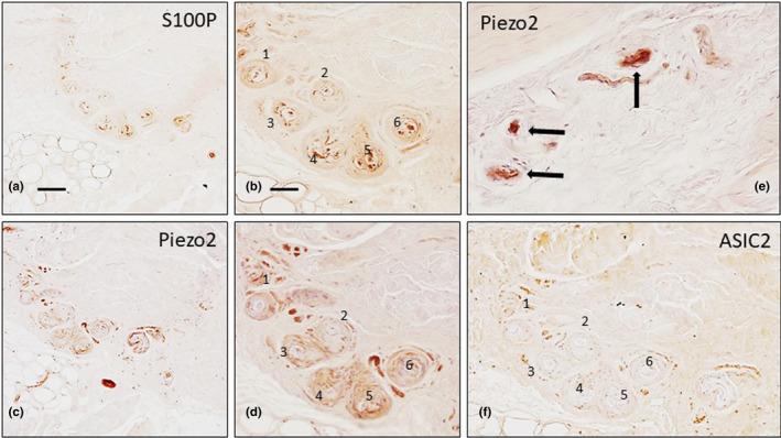 https://cdn.ncbi.nlm.nih.gov/pmc/blobs/5584/9005682/ac912e2de346/JOA-240-972-g010.jpg