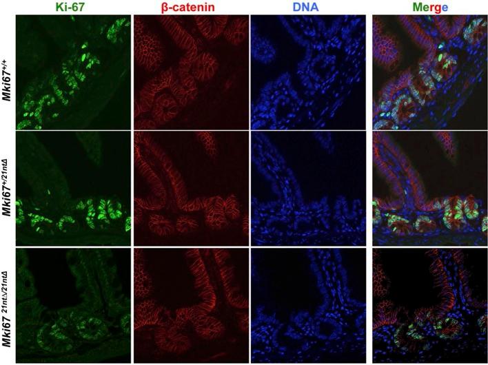 https://cdn.ncbi.nlm.nih.gov/pmc/blobs/5587/4841783/2587b4af2d45/elife-13722-fig3-figsupp3.jpg