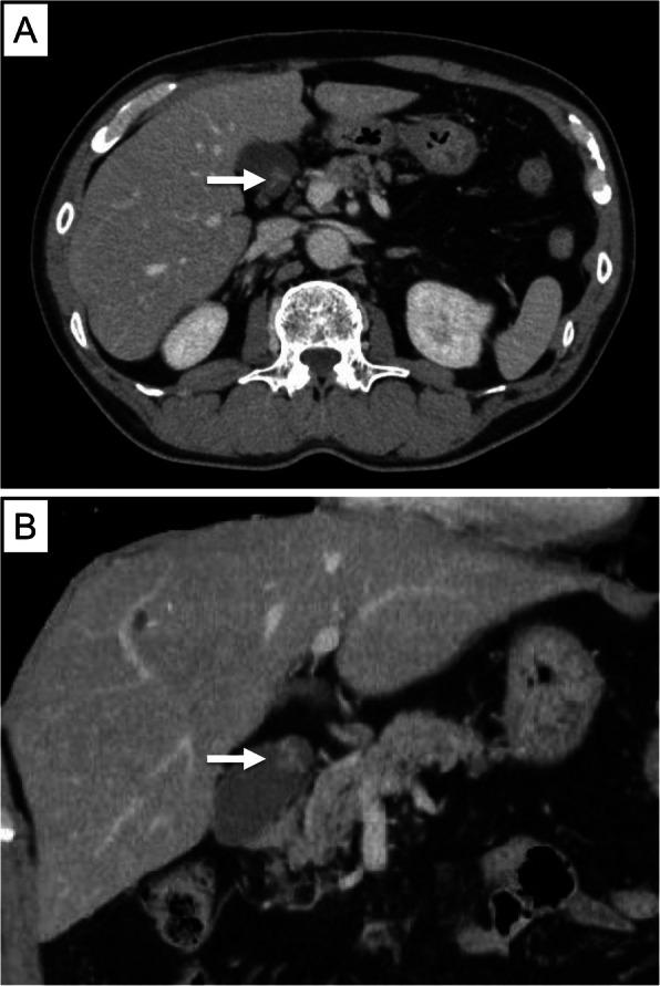 https://cdn.ncbi.nlm.nih.gov/pmc/blobs/5588/7778816/0c28d4ce2183/12957_2020_2104_Fig2_HTML.jpg