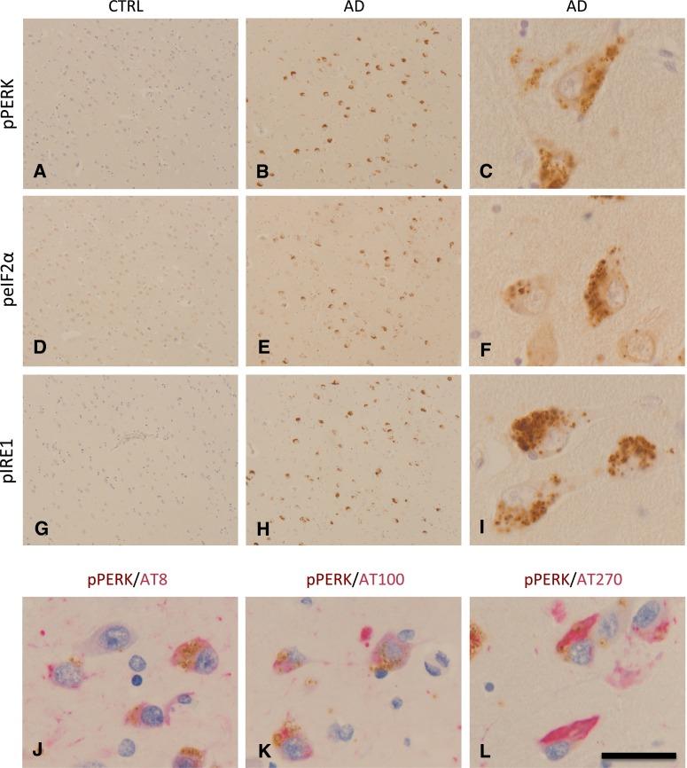 https://cdn.ncbi.nlm.nih.gov/pmc/blobs/558b/4541706/7e881ebe8be4/401_2015_1462_Fig2_HTML.jpg