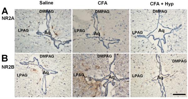 https://cdn.ncbi.nlm.nih.gov/pmc/blobs/558e/2803476/121cab6f8bb8/1744-8069-5-71-2.jpg