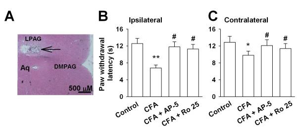 https://cdn.ncbi.nlm.nih.gov/pmc/blobs/558e/2803476/b45686b9b8ab/1744-8069-5-71-5.jpg