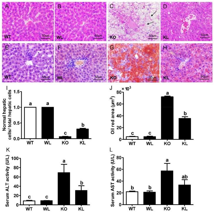 https://cdn.ncbi.nlm.nih.gov/pmc/blobs/558f/9180543/1d5113b2410b/foods-11-01638-g004.jpg