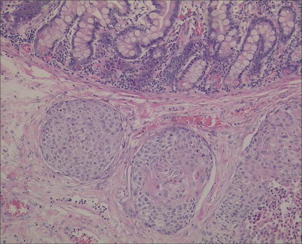 https://cdn.ncbi.nlm.nih.gov/pmc/blobs/55a4/1180466/be41ebc1ad08/1477-7800-2-13-2.jpg